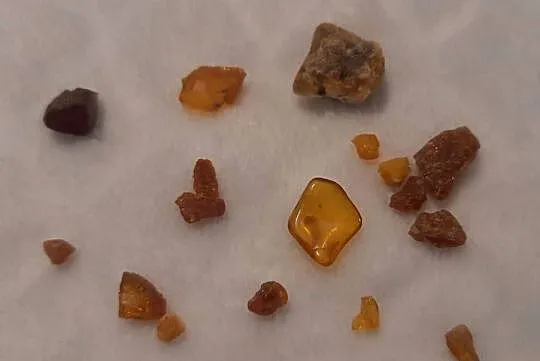 Zestaw bursztynów 1,5cm (17szt.) (Kreatywne), Śląskie, Czeladź