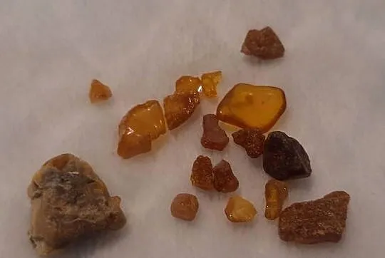 Zestaw bursztynów 1,5cm (17szt.) (Kreatywne), Śląskie, Czeladź