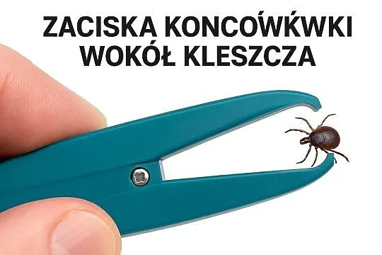 URZĄDZENIE ELEKTRYCZNE DO USUWANIA KLESZCZY – PROSTE I SKUTECZNE, Warmińsko-mazurskie, Mszanowo
