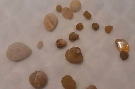 Zestaw kamyczków 0,7-2,1cm (18szt.) 21g (Kreatywne), Śląskie, Czeladź